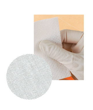 Amalgam Squeeze Cloth, Box of 500 #S5C (Fine Woven) *Clearance* - by CROSSTEX